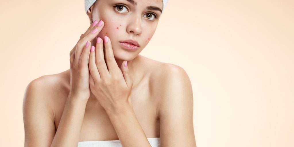 Wypryski i ropne pryszcze na twarzy po 30, 40 i 50-tce