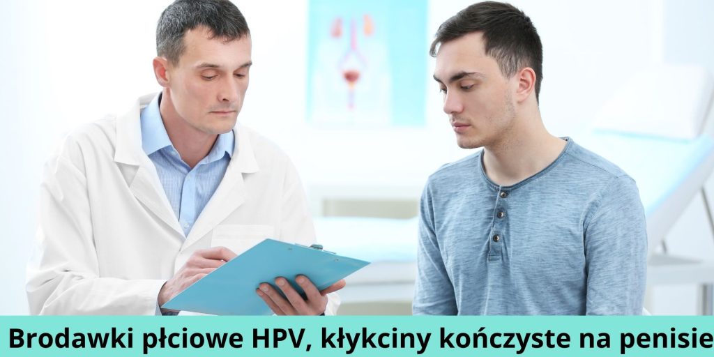 Brodawki płciowe HPV, kłykciny kończyste na penisie