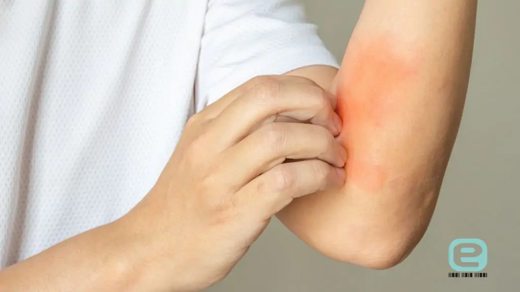 Marsz alergiczny