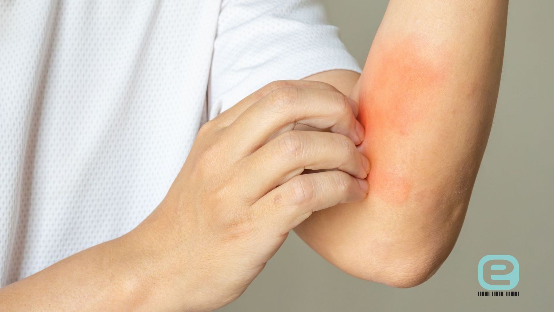 Marsz alergiczny
