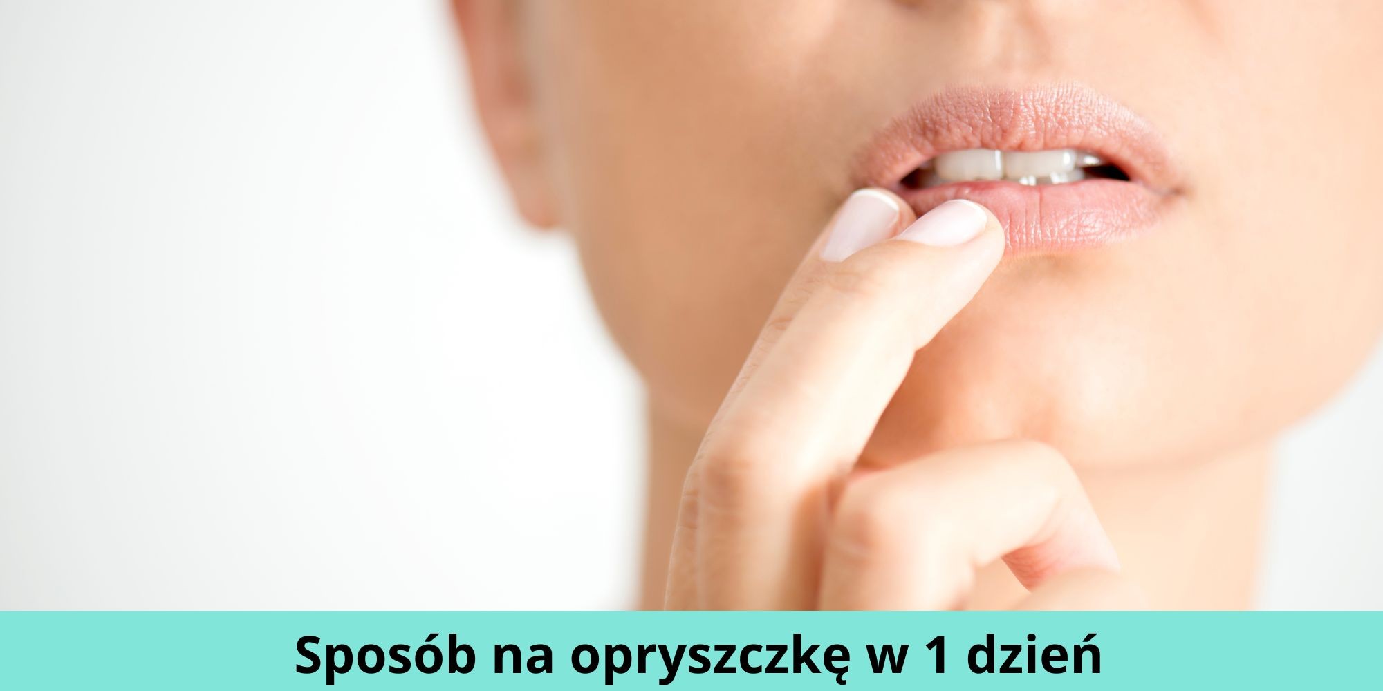 Sposób Na Opryszczkę W 1 Dzień Jak Szybko Poradzić Sobie Z Zimnem Na Ustach 1453