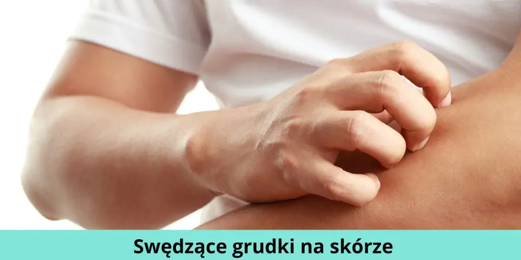 Swędzące grudki na skórze