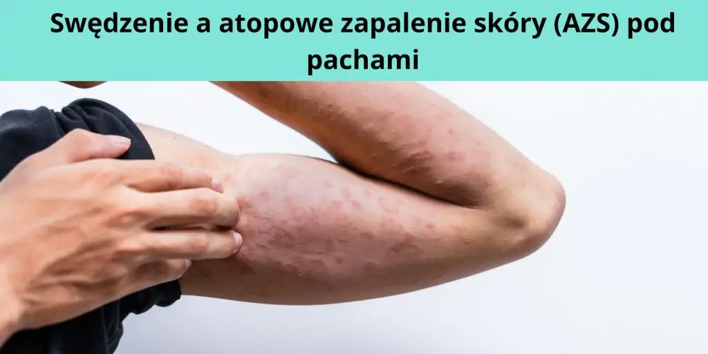 Swędzenie a atopowe zapalenie skóry (AZS) pod pachami