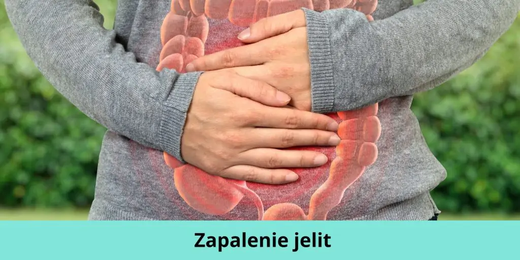 Zapalenie jelit