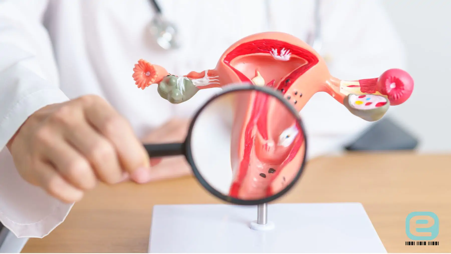 Endometrioza