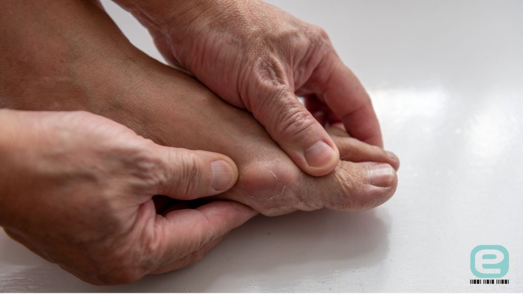 Napad (atak) dny moczanowej