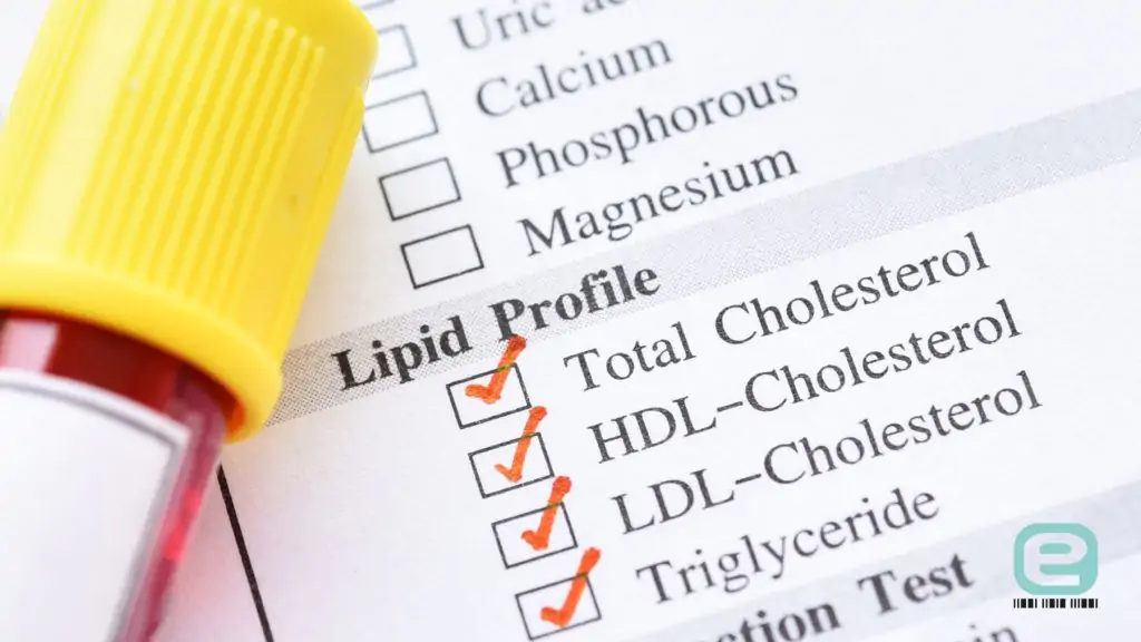 Lipidogram (profil lipidowy)