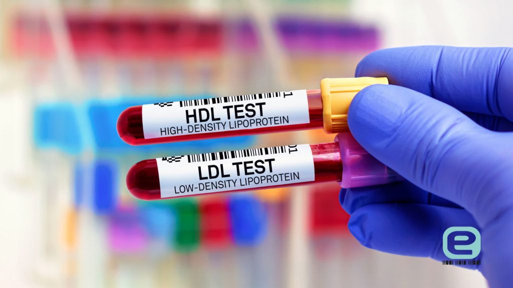 Cholesterol: całkowity, HDL, LDL, nie-HDL