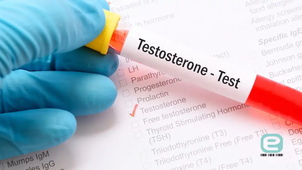 Wysoki testosteron u mężczyzn