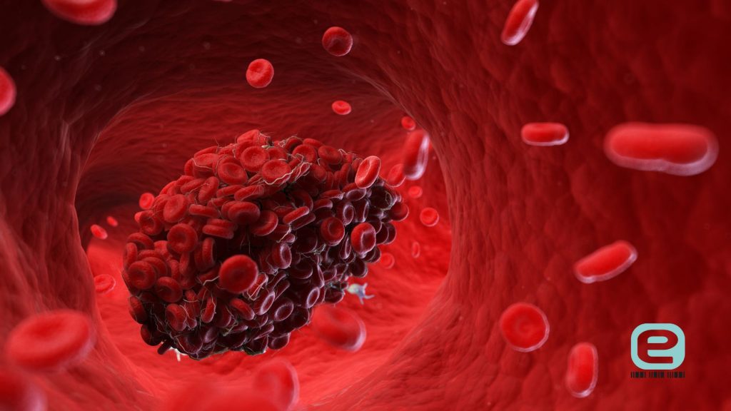 Zaburzenia krzepliwości krwi