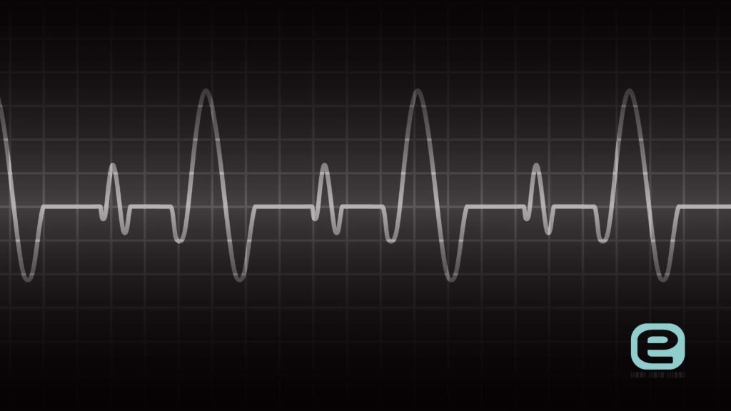 Zaburzenia rytmu serca