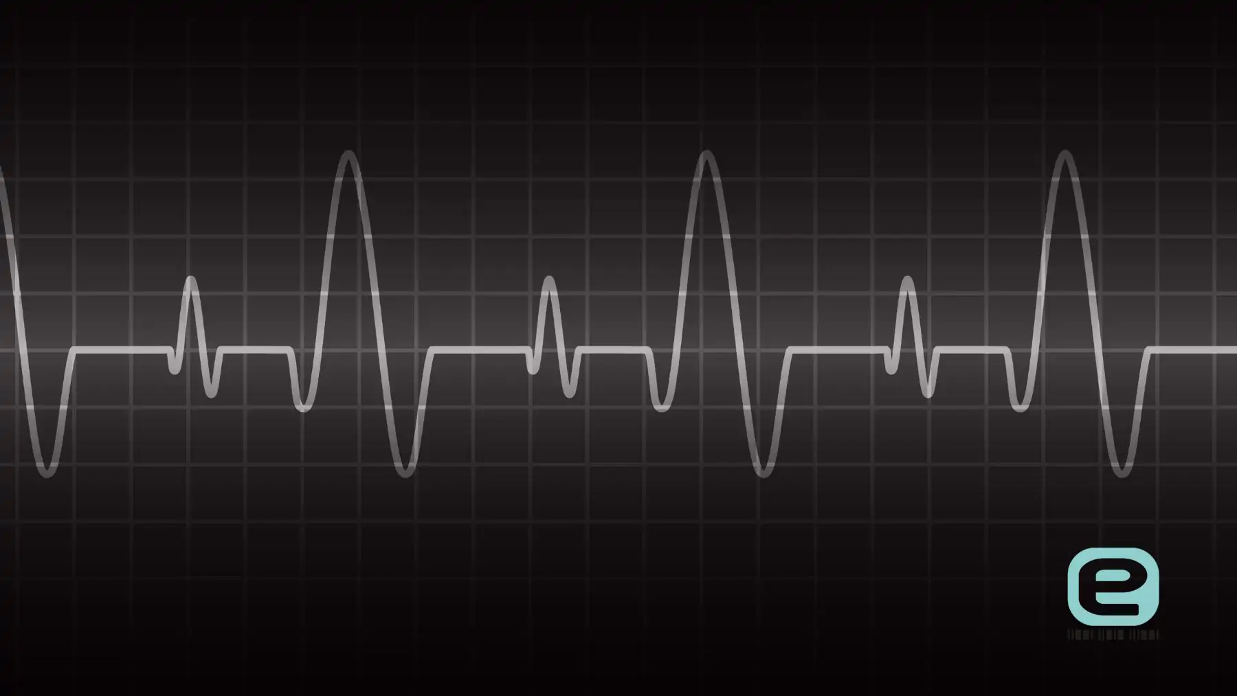 Zaburzenia rytmu serca