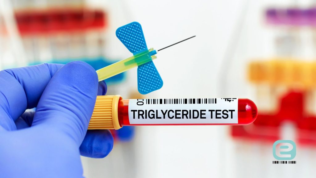 Triglicerydy (trójglicerydy)