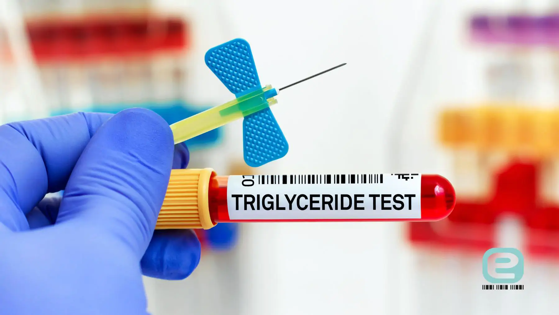 Triglicerydy (trójglicerydy)