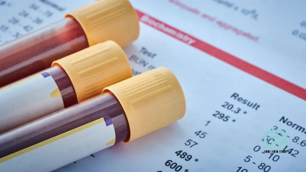 Badanie antygenu PSA