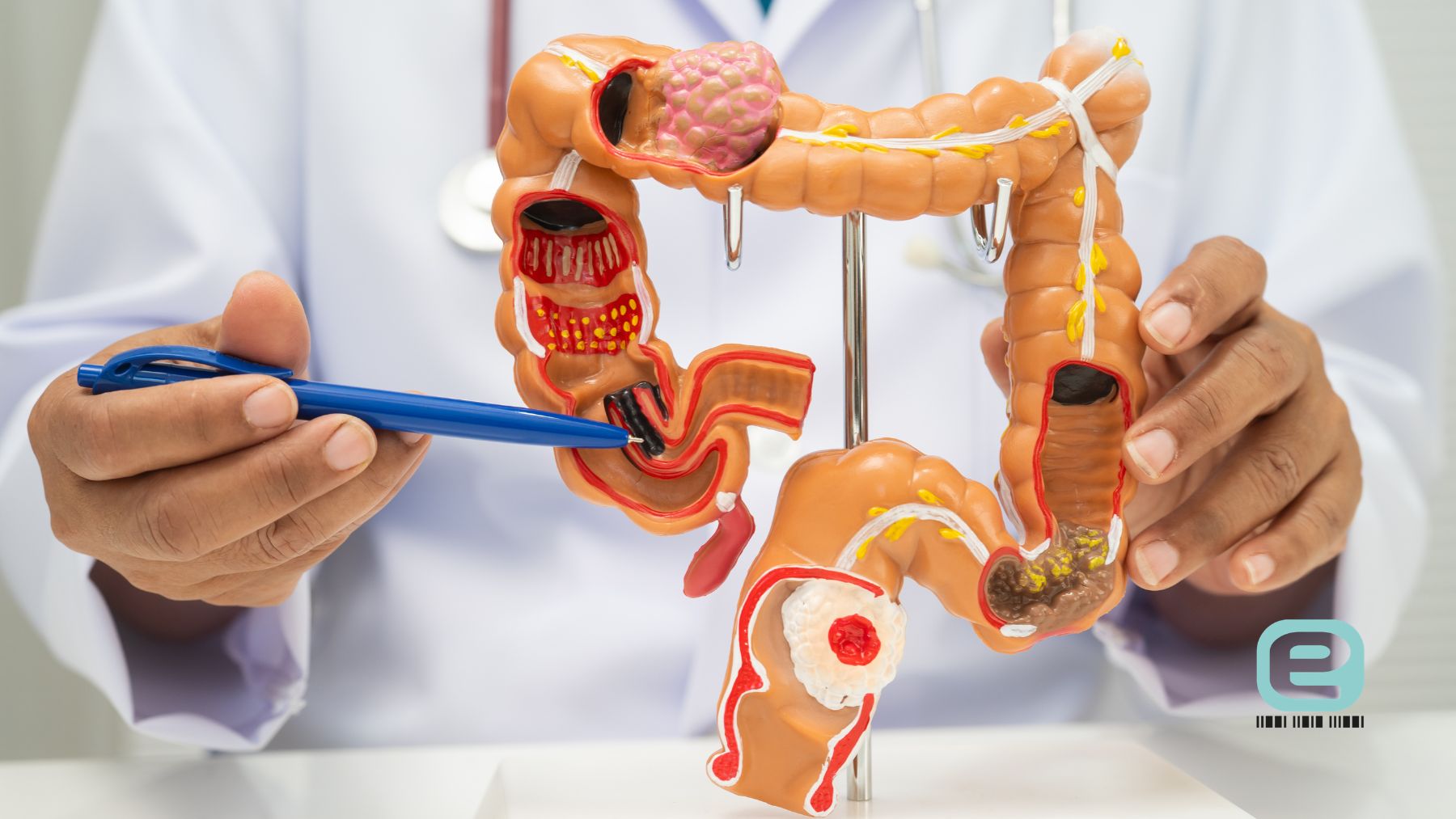 Jak leki na odchudzanie wpływają na perystaltykę jelit?