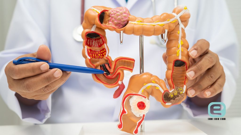 Jak leki na odchudzanie wpływają na perystaltykę jelit?