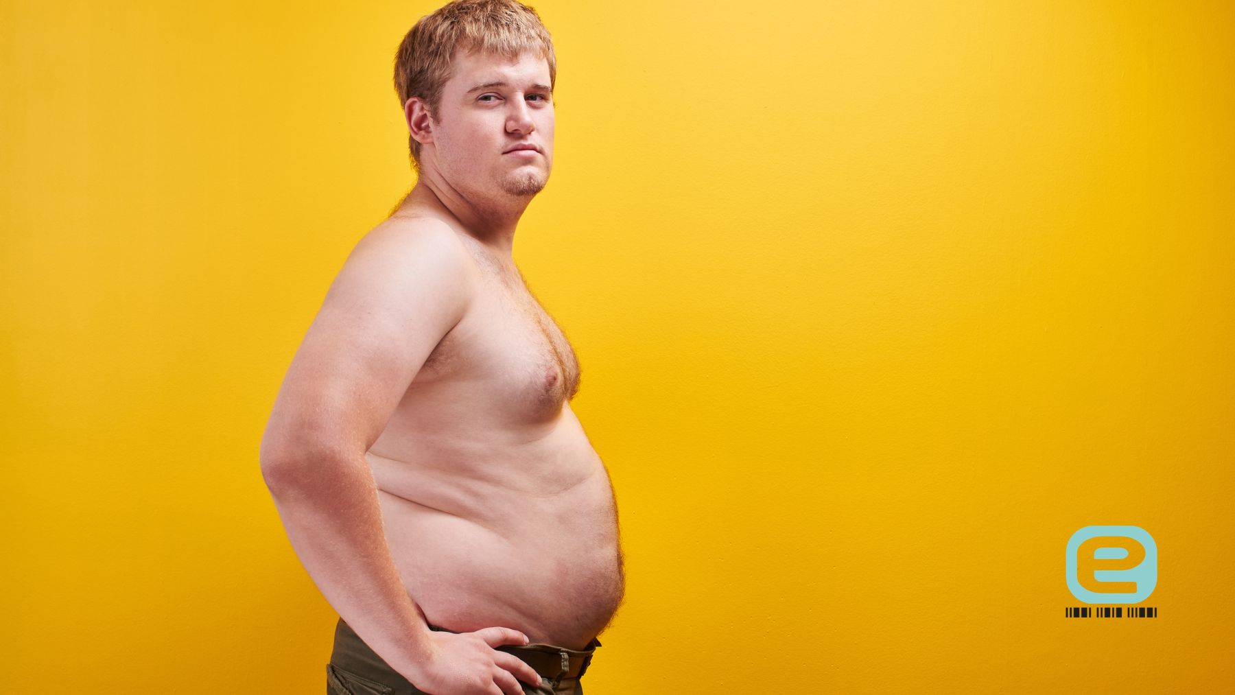 Otyłość gynoidalna (typ gruszki)