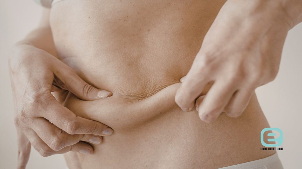 Redukcja tkanki tłuszczowej