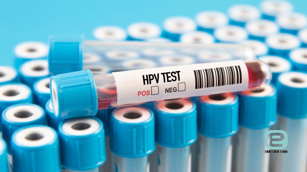 Profilaktyczne badania HPV