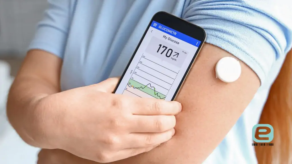 sensor glukozy (CGM)