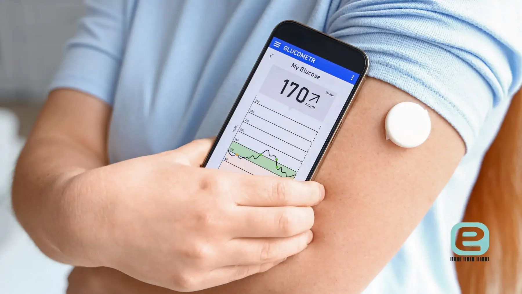 sensor glukozy (CGM)